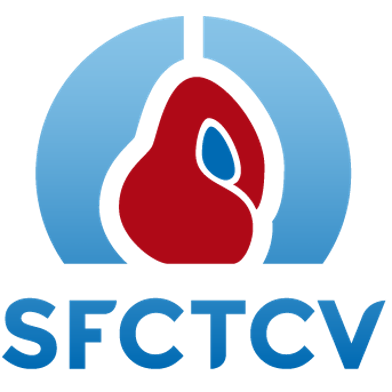 SFCTCV
